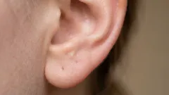 Prečo máme v ušiach toľko ušného mazu: pravda, o ktorej sa nehovorí